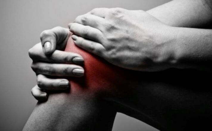 Knee knot arthritis