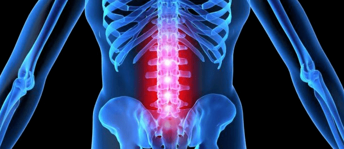 Deformation of the intervertebral disk