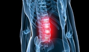 second stage of development of lumbar osteochondrosis