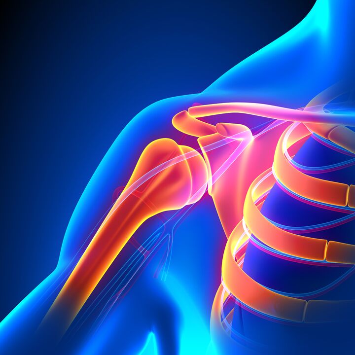 osteoarthritis of the shoulders