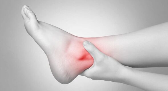 Joint stiffness and chronic ankle pain are complications of cruciarthrosis